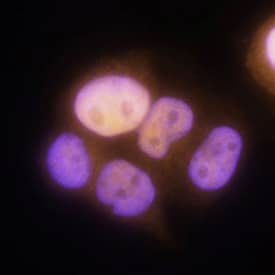 Progesterone R/NR3C3 antibody in T47D Human Cell Line by Immunocytochemistry (ICC).