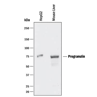 Detection of Human and Mouse Progranulin/PGRN antibody by Western Blot.