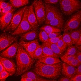 Prohibitin antibody in MCF-7 Human Cell Line by Immunocytochemistry (ICC).