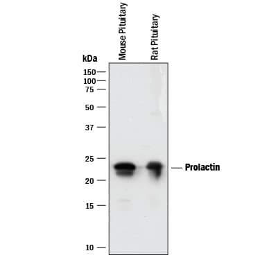 Detection of Mouse and Rat Prolactin antibody by Western Blot.