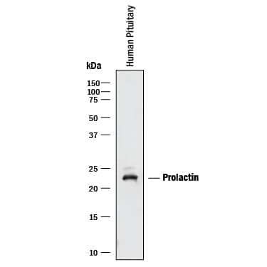 Detection of Human Prolactin antibody by Western Blot.