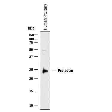 Detection of Human Prolactin antibody by Western Blot.