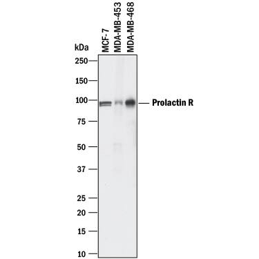 Detection of Human Prolactin R antibody by Western Blot.