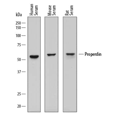 Detection of Human, Mouse, and Rat Properdin antibody by Western Blot.