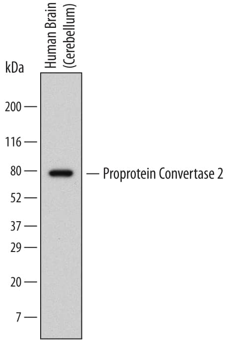 Detection of Human Proprotein Convertase 2/PCSK2 antibody by Western Blot.