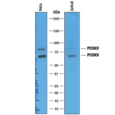 Detection of Human Proprotein Convertase 9/PCSK9 antibody by Western Blot.