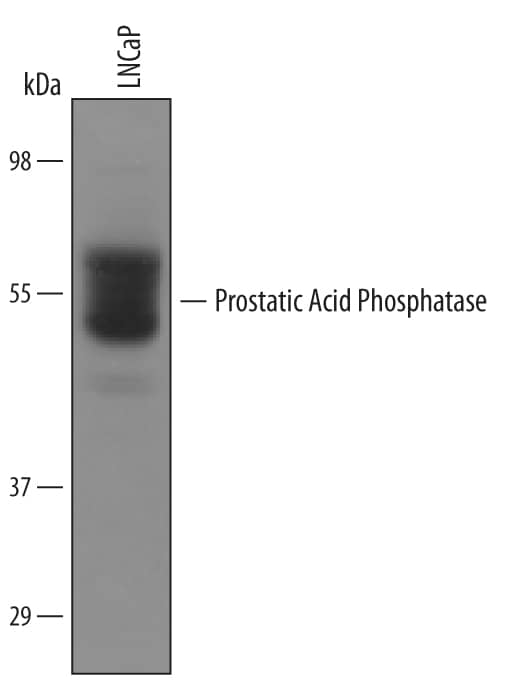 Detection of Human Prostatic Acid Phosphatase/ACPP antibody by Western Blot.