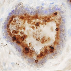 Prostatic Acid Phosphatase/ACPP antibody in Human Prostate by Immunohistochemistry (IHC-P).
