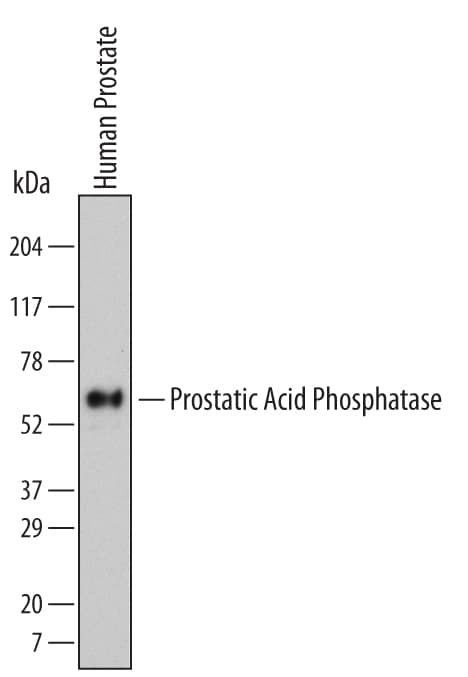 Detection of Human Prostatic Acid Phosphatase/ACPP antibody by Western Blot.