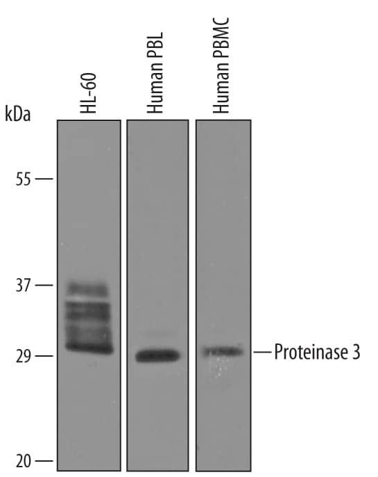 Detection of Human Proteinase 3/Myeloblastin/ PRTN3 antibody by Western Blot.