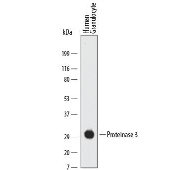 Detection of Human Proteinase 3/Myeloblastin/PRTN3 antibody by Western Blot.