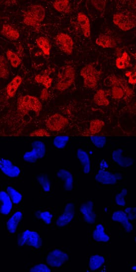Protocadherin-1 antibody in BG01V Human Embryonic Stem Cells by Immunocytochemistry (ICC).