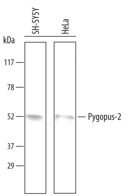 Detection of Human Pygopus-2 antibody by Western Blot.