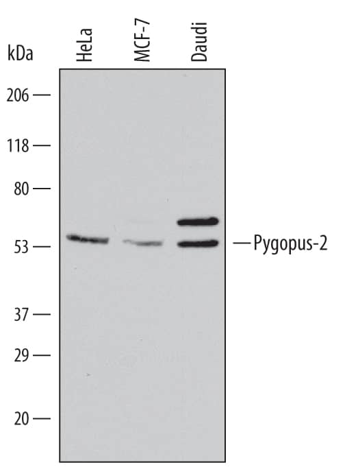 Detection of Human Pygopus-2 antibody by Western Blot.