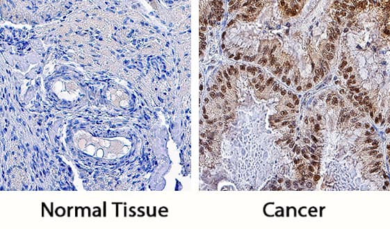 Pygopus-2 antibody in Human Ovary and Human Ovarian Cancer Tissue by Immunohistochemistry (IHC-P).