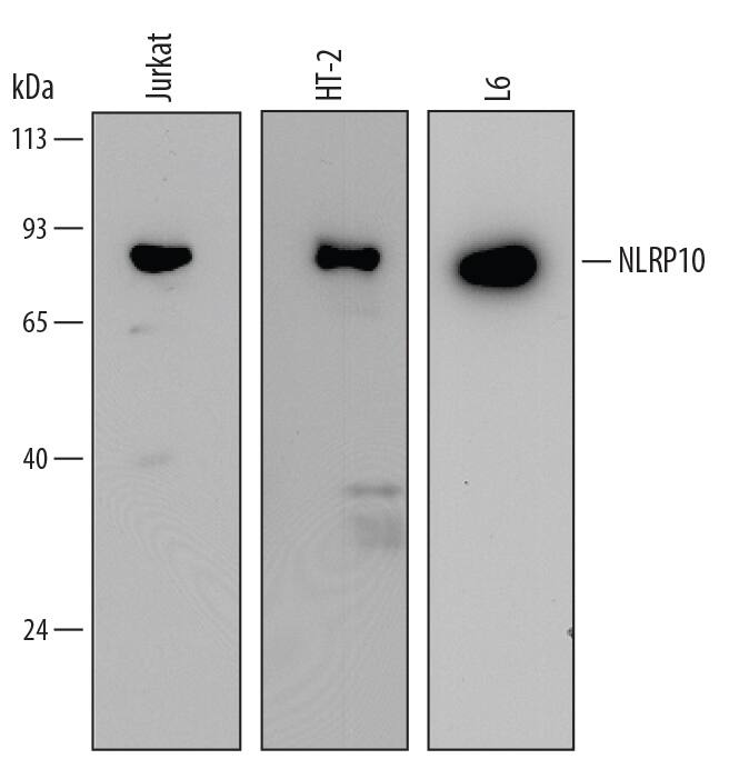 Detection of Human, Mouse, and Rat NLRP10/Pynod/NALP10 antibody by Western Blot.