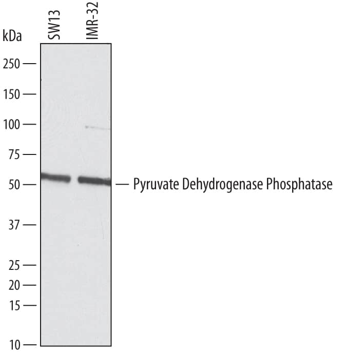 Detection of Human Pyruvate Dehydrogenase Phosphatase/PDP1 antibody by Western Blot.