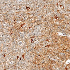 Glutaminyl-peptide Cyclotransferase/QPCT antibody in Human Brain by Immunohistochemistry (IHC-P).