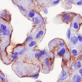 RAGE antibody in Human Lung by Immunohistochemistry (IHC-P).