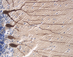 RAGE antibody in Human Alzheimer's Disease Brain by Immunohistochemistry (IHC-P).