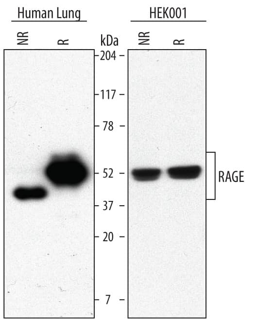 Detection of Human RAGE antibody by Western Blot.