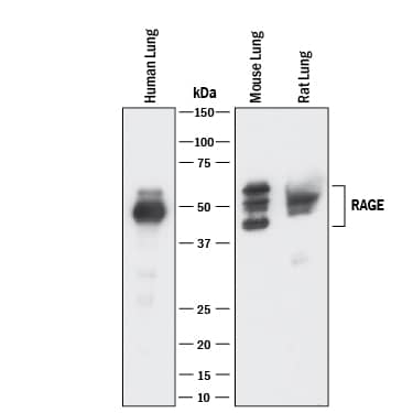 Detection of Human, Mouse, and Rat RAGE antibody by Western Blot.