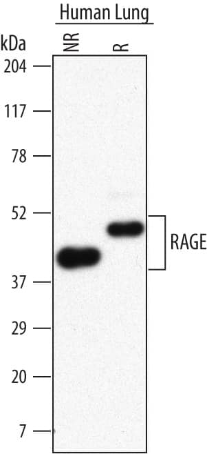 Detection of Human RAGE antibody by Western Blot.