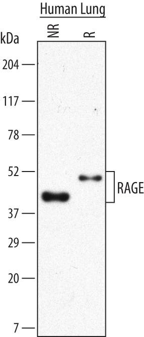 Detection of Human RAGE antibody by Western Blot.