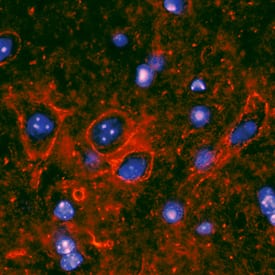 RAGE antibody in Mouse Spinal Cord by Immunohistochemistry (IHC-Fr).