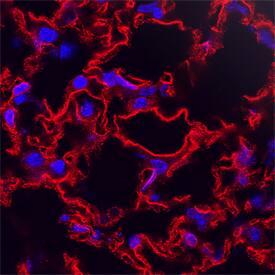 RAMP2 antibody in Mouse Lung by Immunohistochemistry (IHC-Fr).