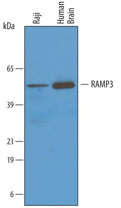 Detection of Human RAMP3 antibody by Western Blot.