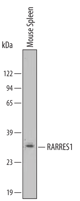 Detection of Mouse RARRES1 antibody by Western Blot.