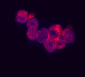 RARRES3 antibody in Raji Human Cell Line by Immunocytochemistry (ICC).