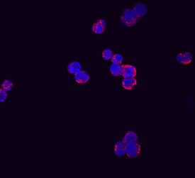 RARRES3 antibody in Raji Human Cell Line by Immunocytochemistry (ICC).