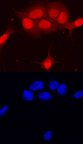 RB1 antibody in MCF-7 Human Cell Line by Immunocytochemistry (ICC).