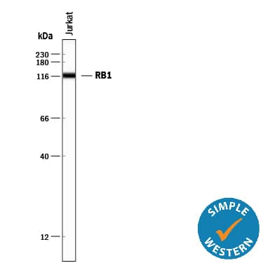 Detection of Human RB1 antibody by Simple WesternTM.