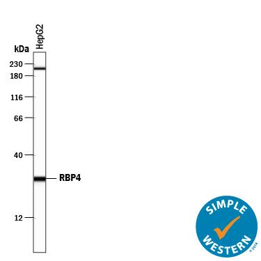 Detection of Human RBP4/Retinol-Binding Protein 4 antibody by Simple WesternTM.