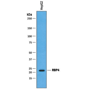 Detection of Human RBP4/Retinol-Binding Protein 4 antibody by Western Blot.