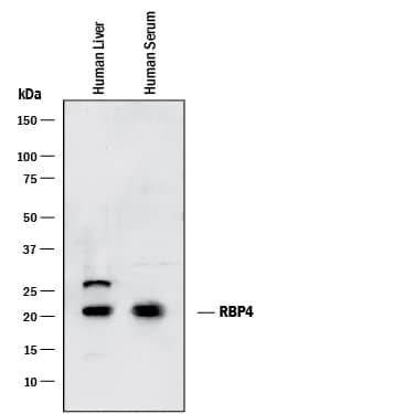 Detection of Human RBP4/Retinol-Binding Protein 4 antibody by Western Blot.