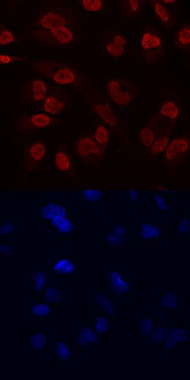 RCOR1/CoREST antibody in HeLa Human Cell Line by Immunocytochemistry (ICC).