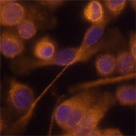 FIZZ1/RELMa antibody in BV-2 Mouse Cell Line by Immunocytochemistry (ICC).