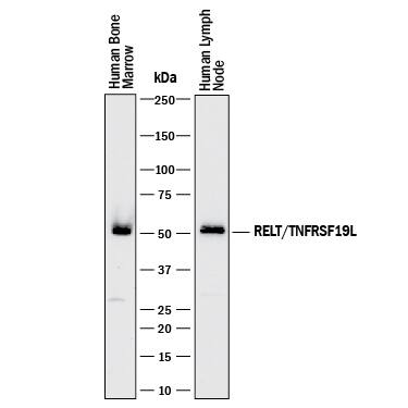 Detection of Human RELT/TNFRSF19L antibody by Western Blot.