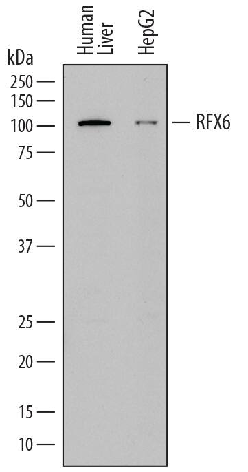 Detection of Human RFX6 antibody by Western Blot.