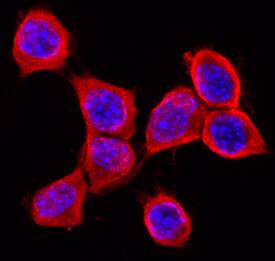 RGM-B antibody in Neuro-2A Mouse Cell Line by Immunocytochemistry (ICC).