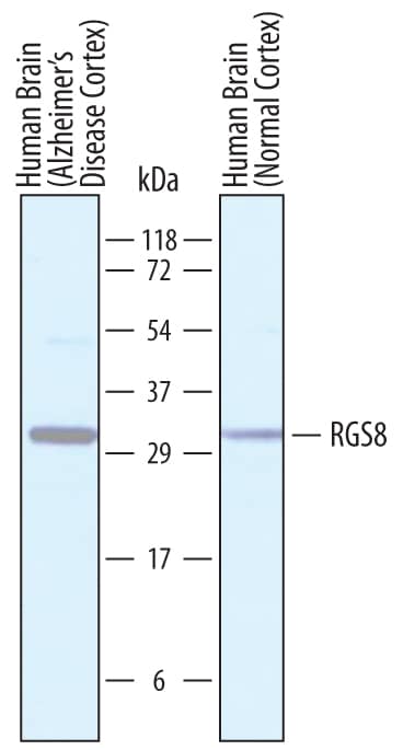 Detection of Human RGS8 antibody by Western Blot.