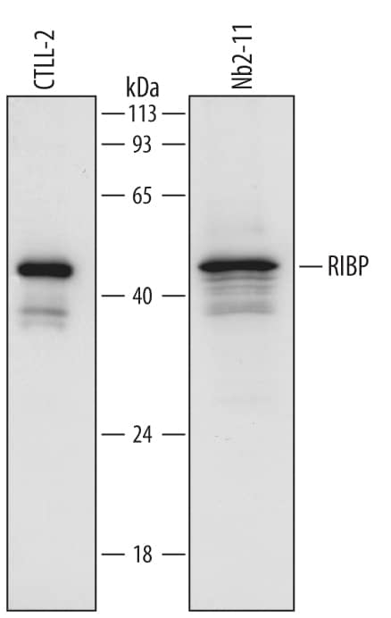 Detection of Mouse and Rat RIBP/SH2D2A antibody by Western Blot.