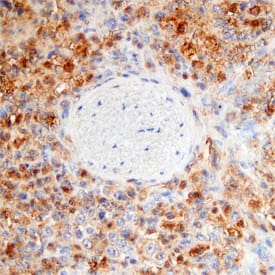 RIPK3/RIP3 antibody in Human Spleen by Immunohistochemistry (IHC-P).
