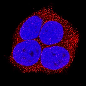 RIPK1/RIP1 antibody in MCF-7 Human Cell Line by Immunocytochemistry (ICC).