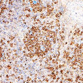 RIPK2/RIP2 antibody in Human Tonsil by Immunohistochemistry (IHC-P).