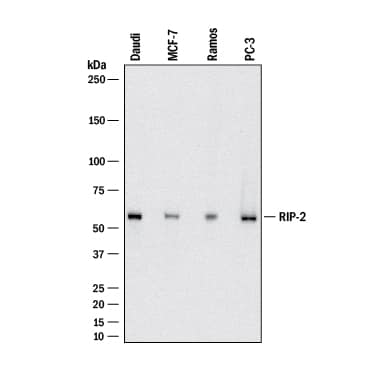 Detection of Human RIPK2/RIP2 antibody by Western Blot.